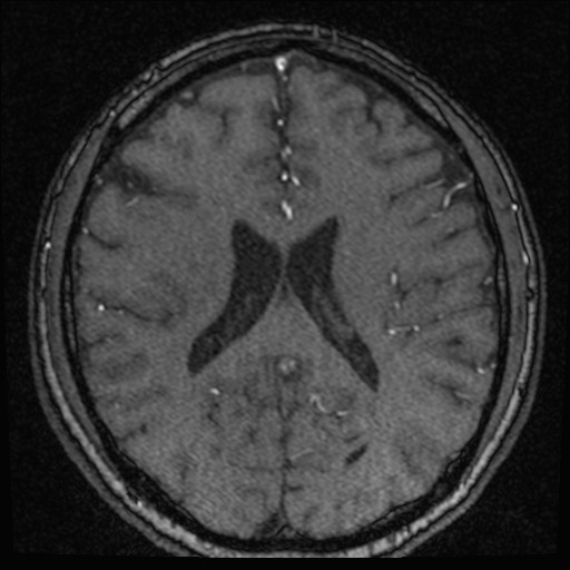 Click on the Serie image to view the images of VILLANUEVA, WILLIAM A.